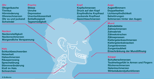 Was sind eigentlich CMD – craniomandibuläre Dysfunktionen